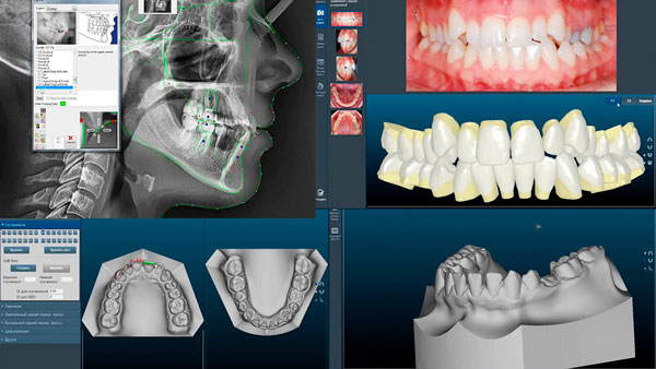 Цифровая стоматология